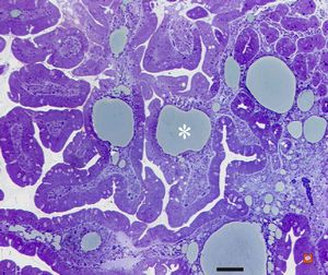 cured Whipple disease (semithin section) cured Whipple disease (semithin section)
